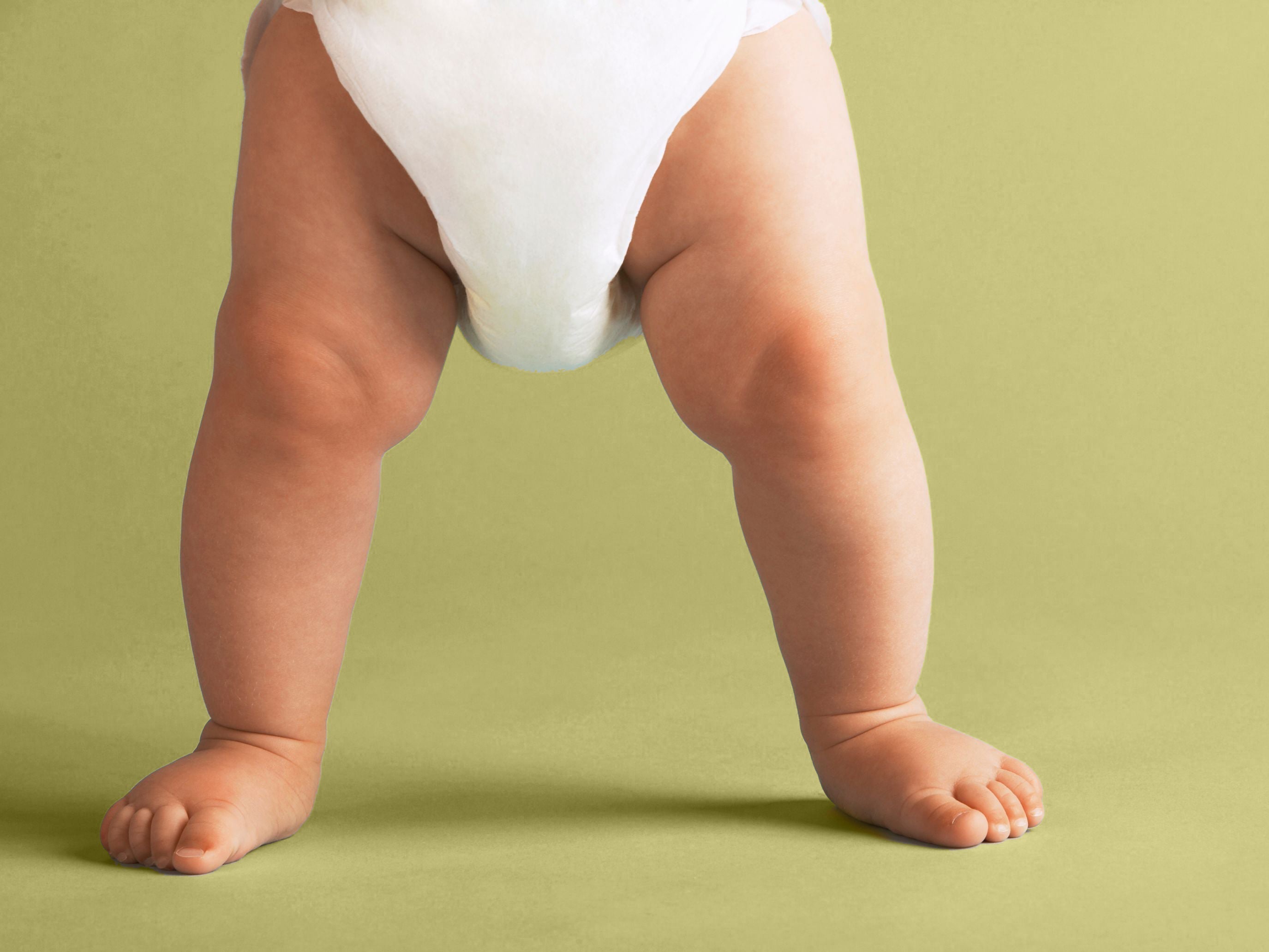 Best Natural Remedies for Nappy Rash: What Actually Works?