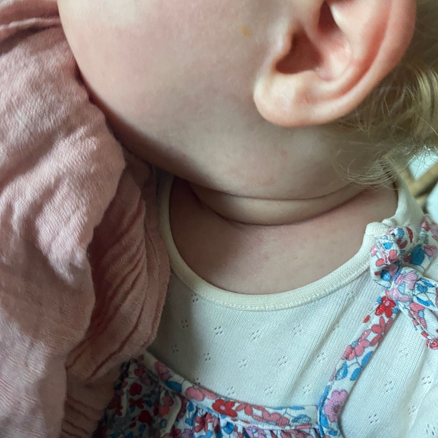 Baby skin looking calmer after using a gentle nappy rash cream for red sore skin